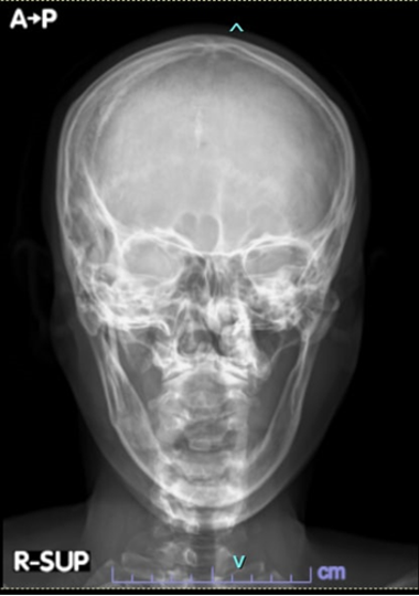 SciEnggJ%202024%20Special%20Issue%20148 154 Maarof%20et%20al